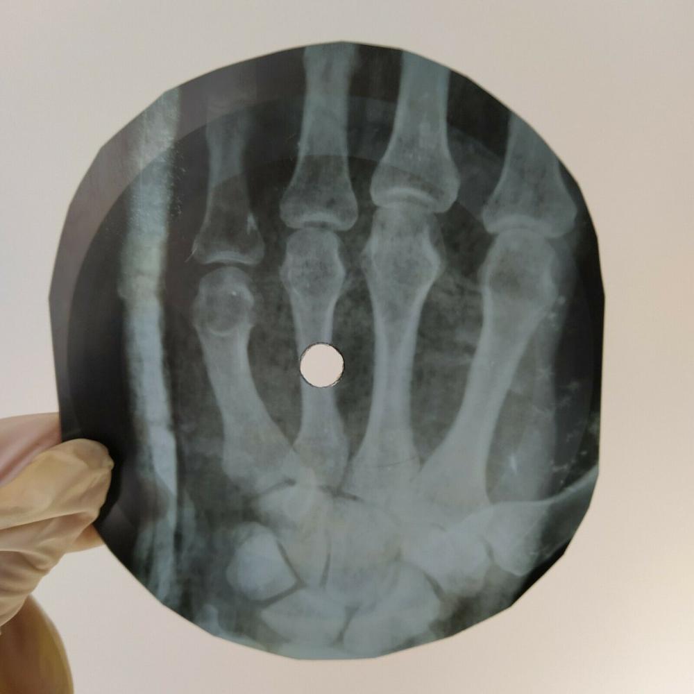 Nina_Simone-Human_Touch-x-ray-URSS-record-Roentgen-OS-côtes-Vinyle-1.jpg.jpg