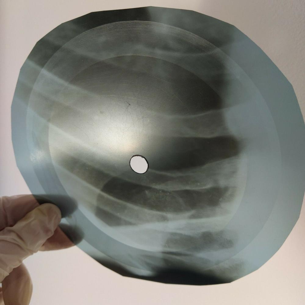 CHRIS_ANDREWS-Yesterday_Man-x-ray-URSS-record-Roentgen-OS-côtes-Vinyle-2.jpg